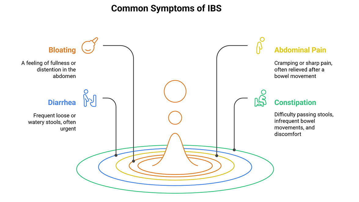 Naturopathic Remedies for IBS Relief 1 Remedies for IBS Relief: Diagram illustrates common symptoms—bloating (abdominal fullness), diarrhea (loose stools), abdominal pain (cramping), and constipation (infrequent bowel movements)—with icons and a central figure.